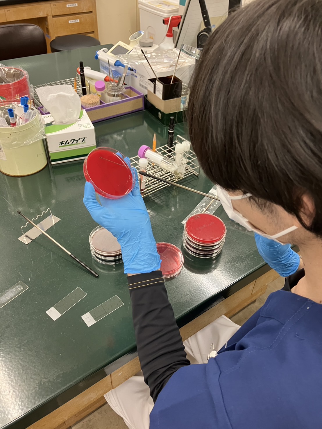 ②細菌検査